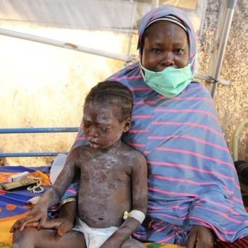 BORNO MEASLES OUTBREAK